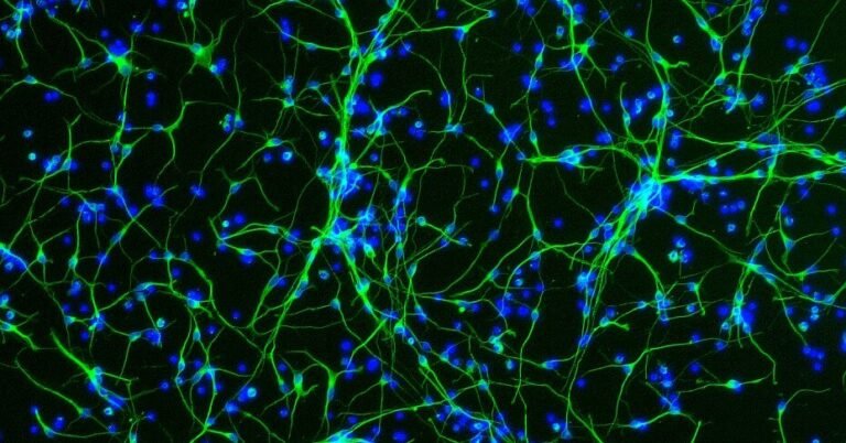 Aging Women’s Brain Mysteries Are Tested in Trio of Studies