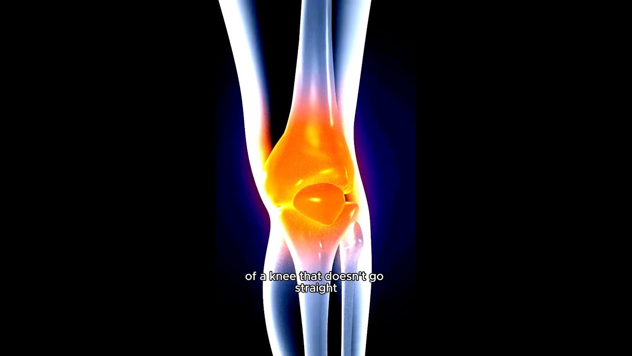 Joint Pain and Rehabilitation