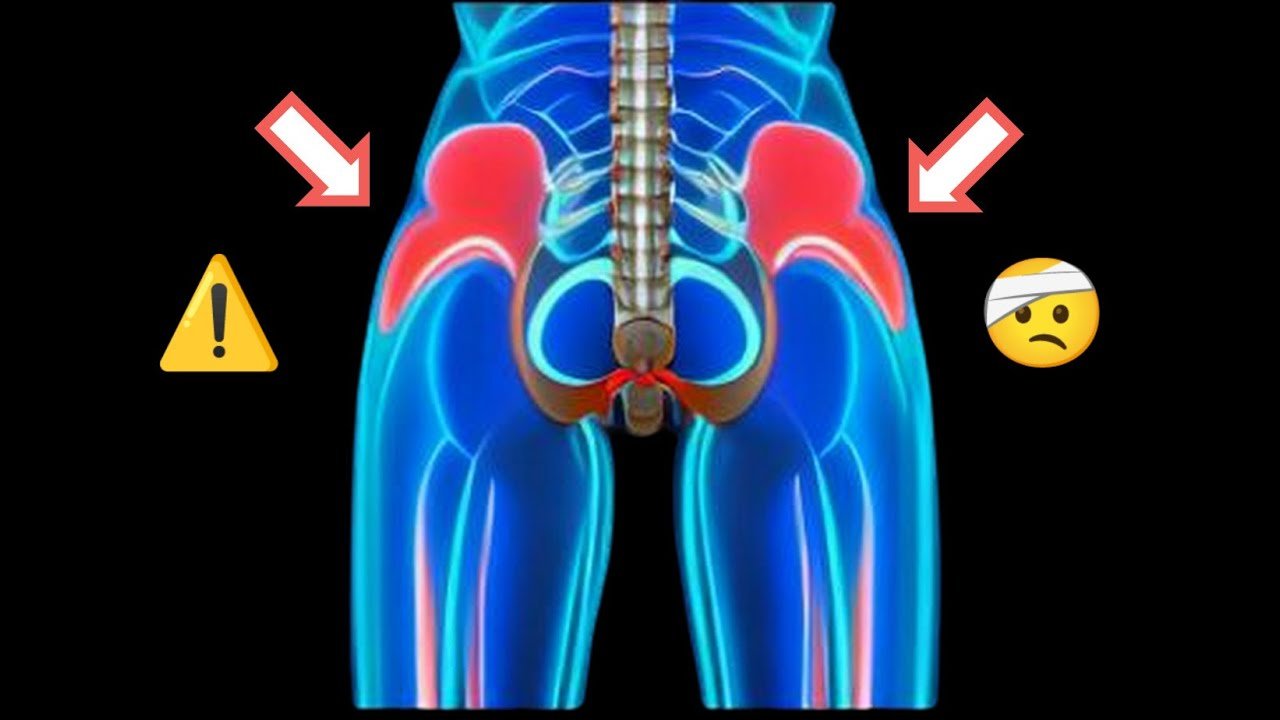 Signs of Hip Damage