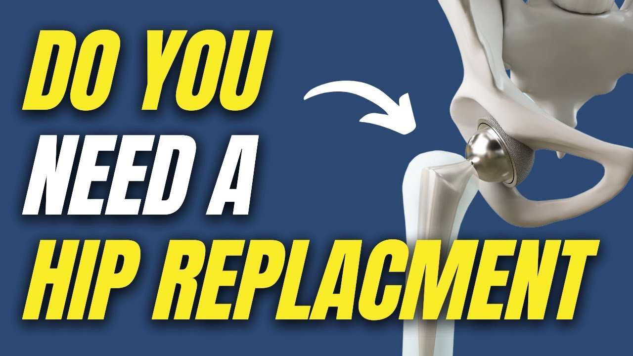 Hip Osteoarthritis Symptoms