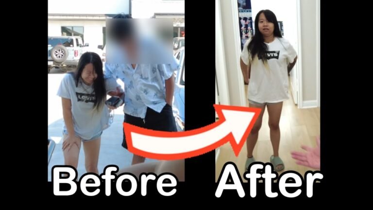 Natural Remedies for Back Pain