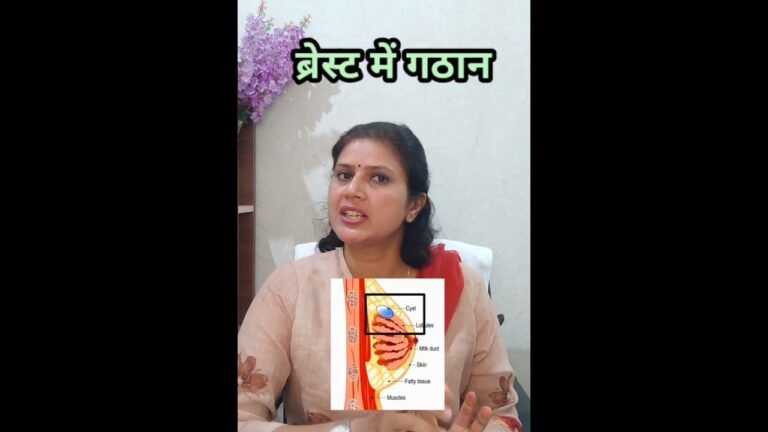 Natural Remedies for Breast Pain