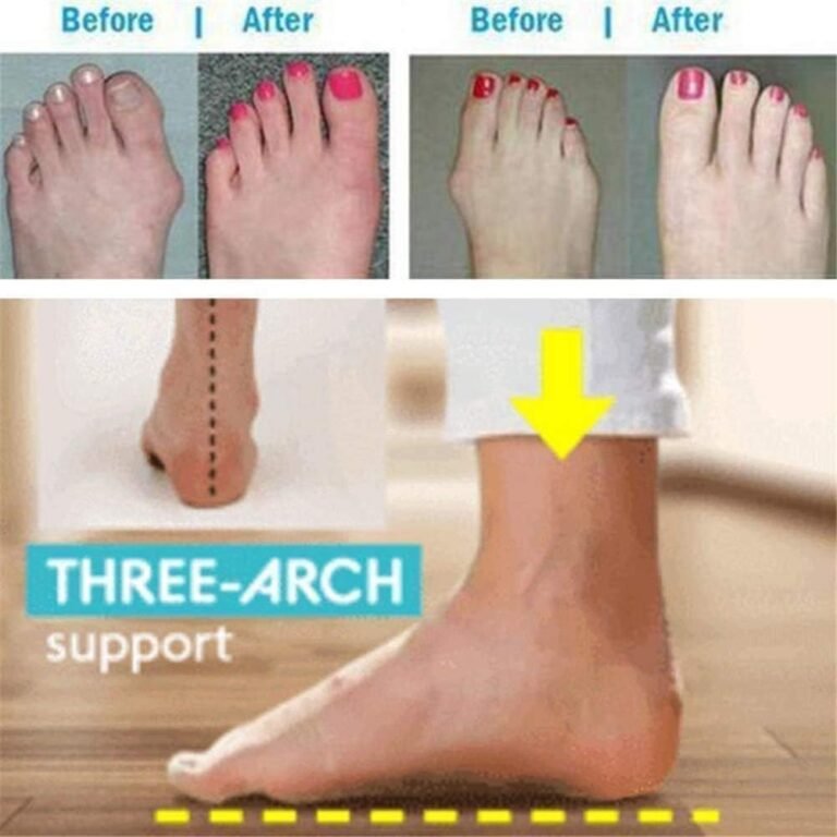 bunion relief shoes