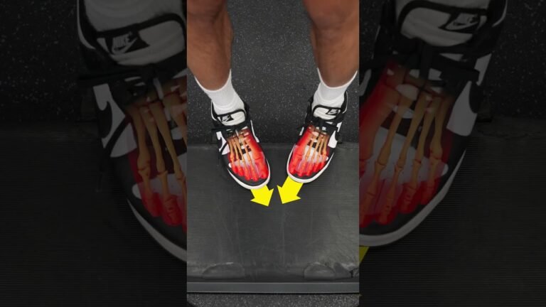 Knee alignment correction tools