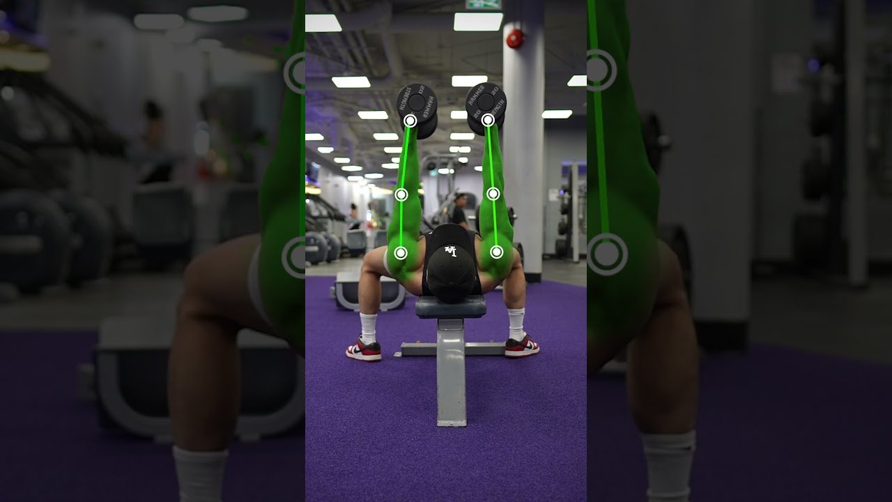 Breast Pain in Athletes