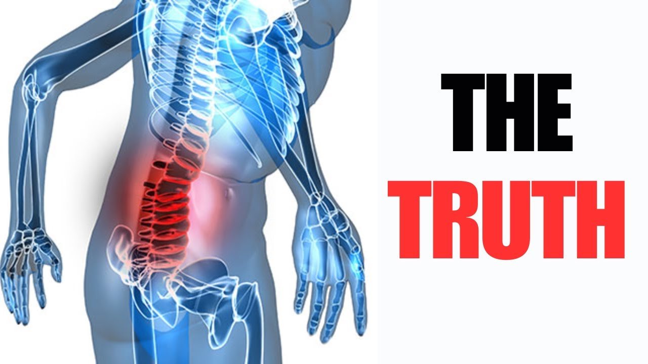 Back Pain and Physical Activity