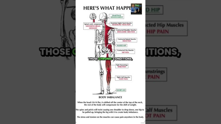Chronic Joint Pain Causes