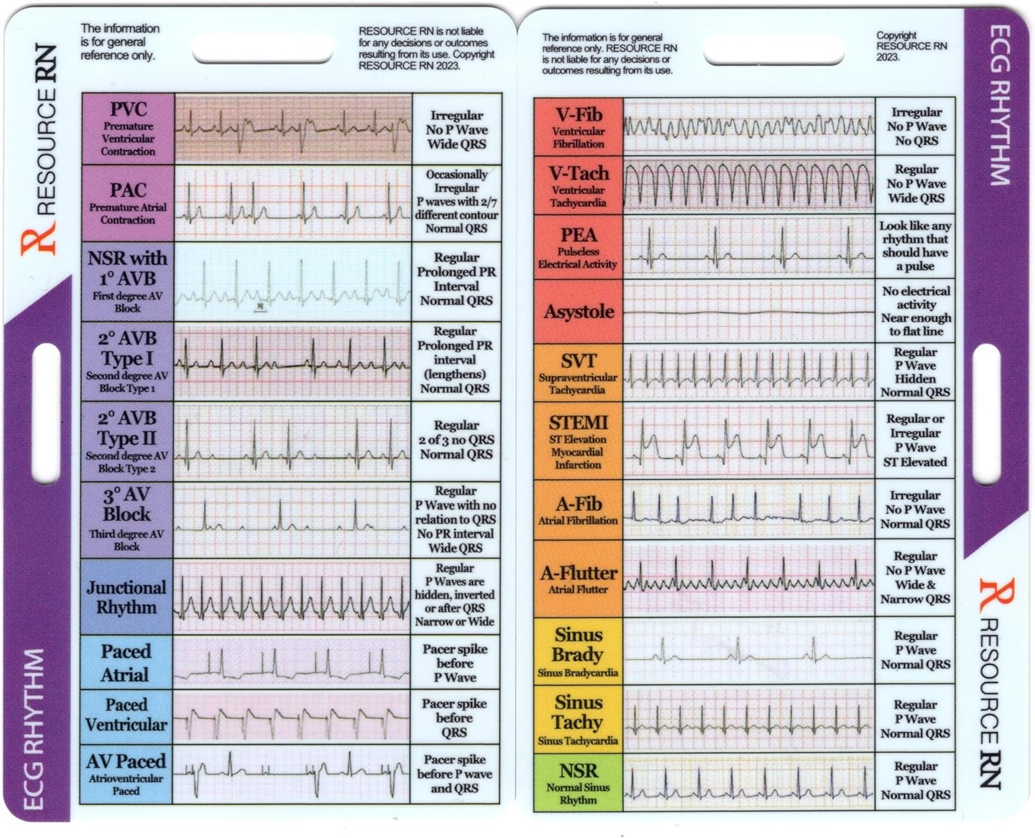 ECG monitors