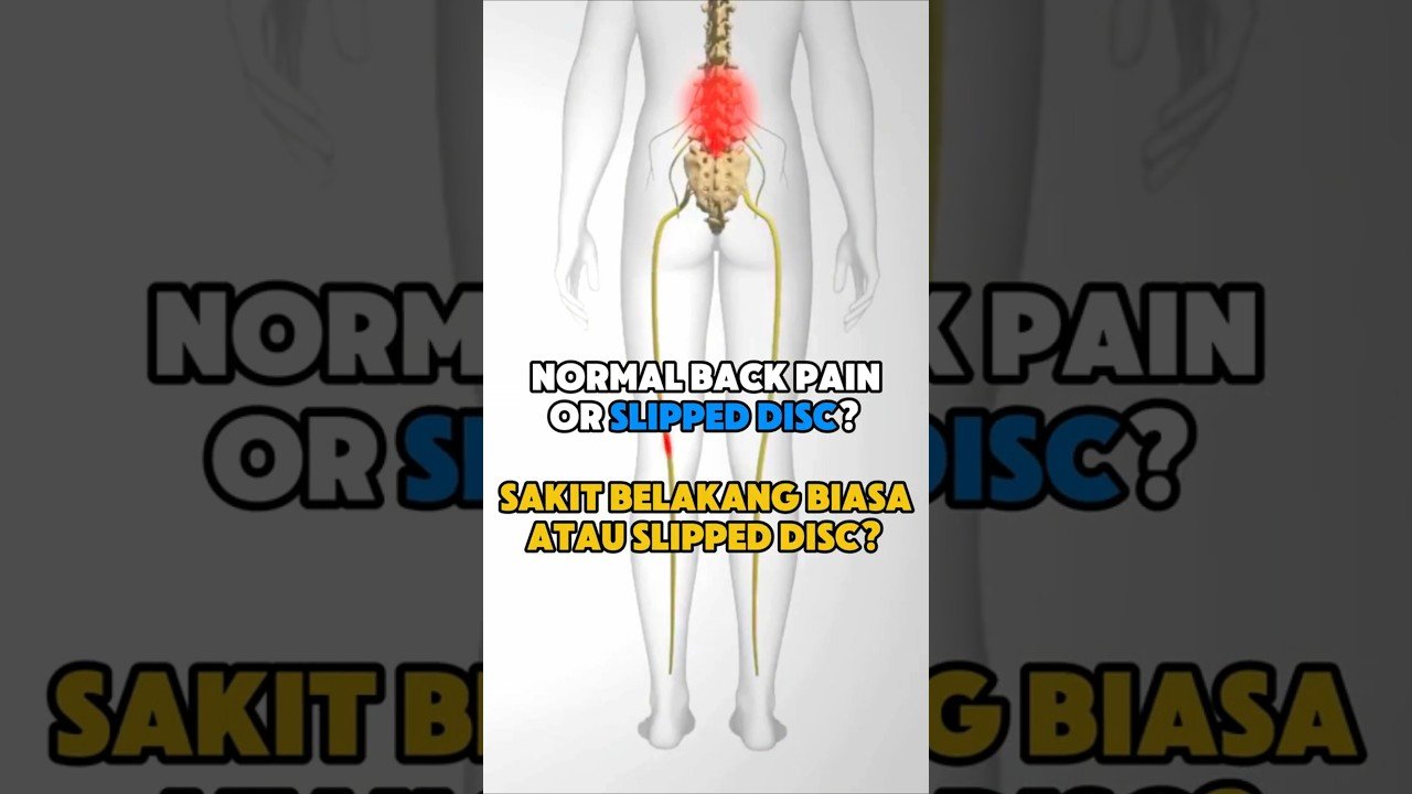 Signs of Back Injury