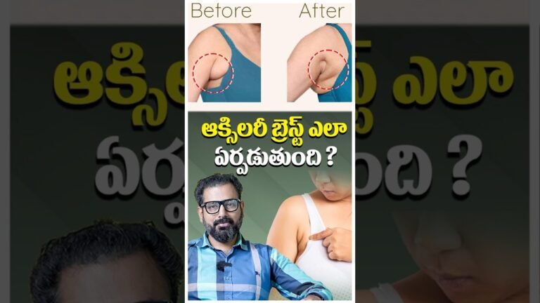 Natural Remedies for Breast Pain