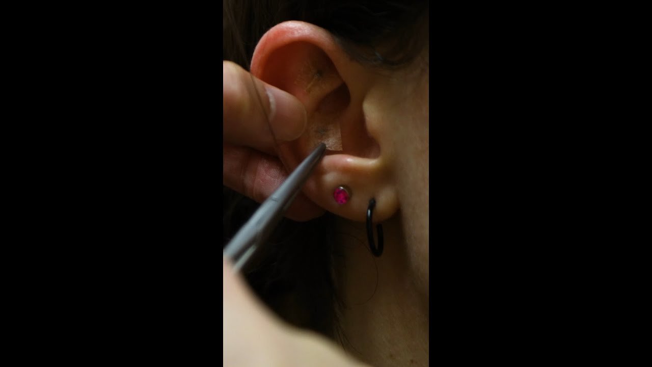 Acupressure for Headaches