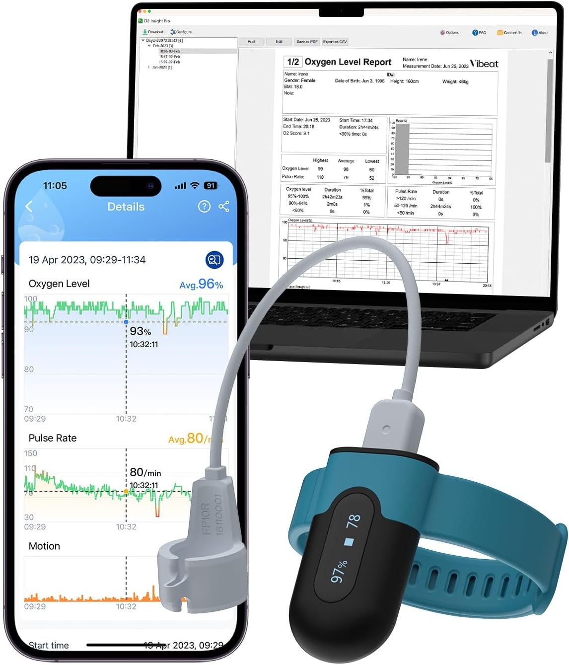 sleep apnea monitors