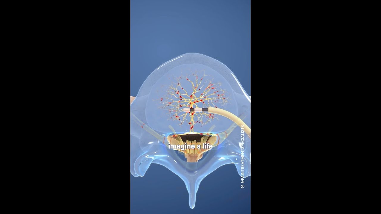 Pain Management Techniques