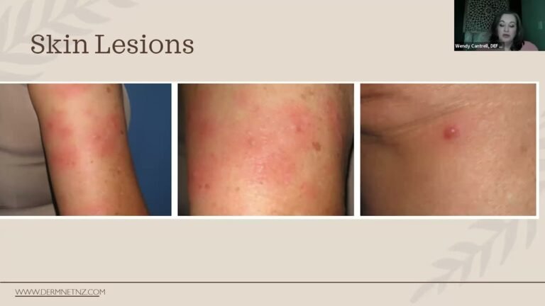 Joint Pain Diagnosis