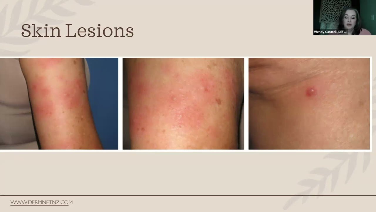 Joint Pain Diagnosis