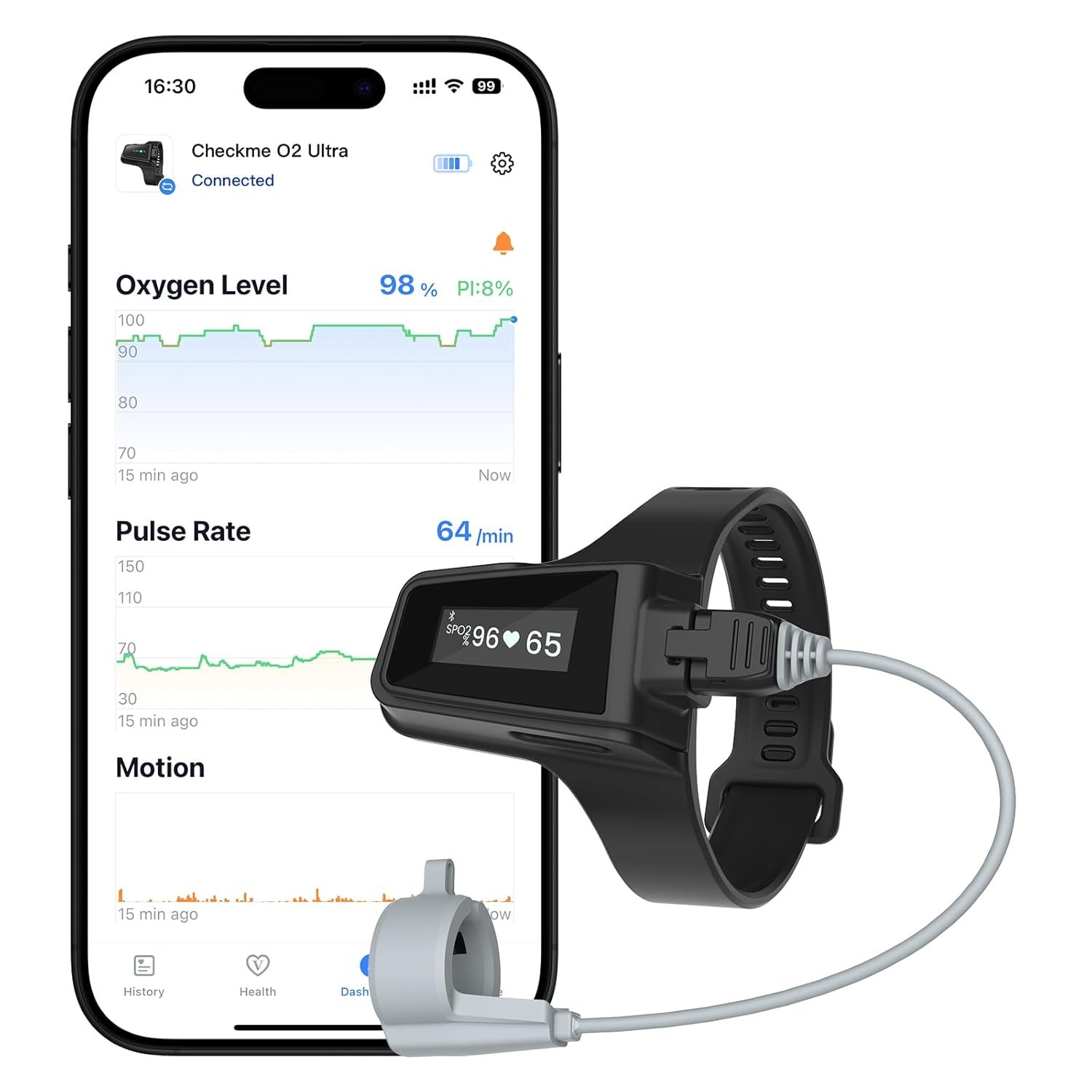 sleep apnea monitors