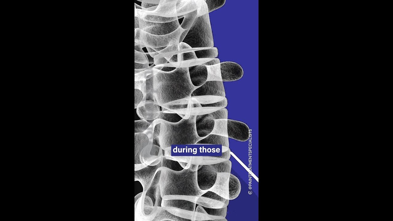 Signs of Back Injury