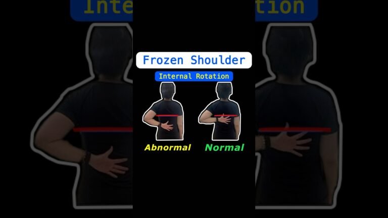 Shoulder Pain and Mobility