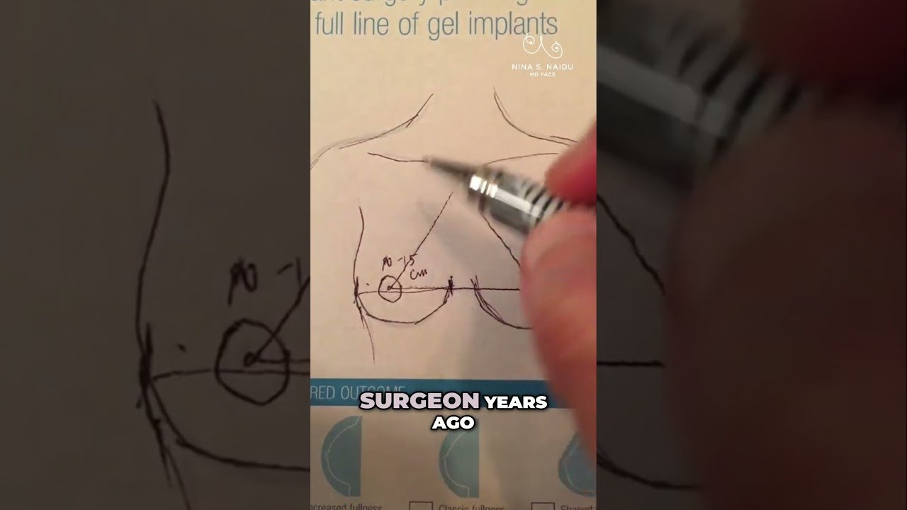 Understanding Breast Anatomy