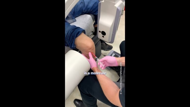 Joint Inflammation Treatment