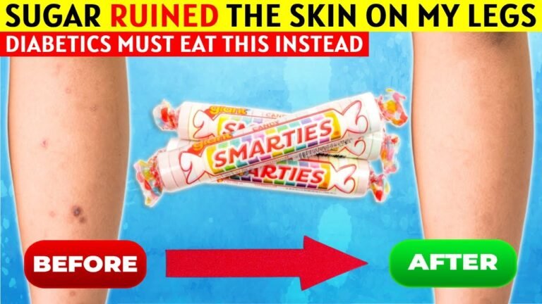 Diabetes