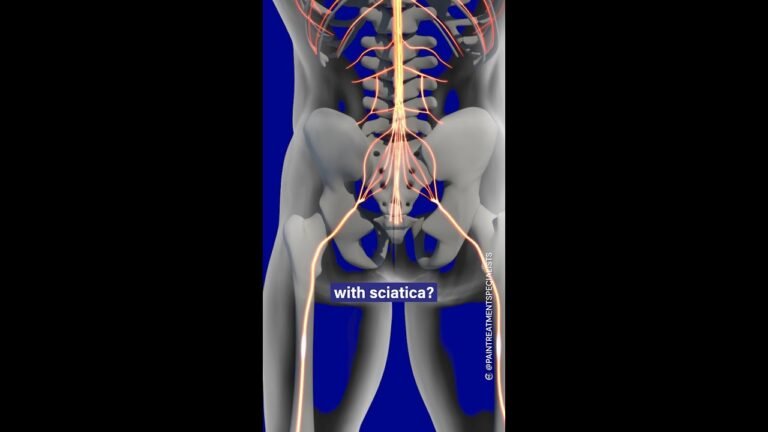 Joint Pain and Mobility