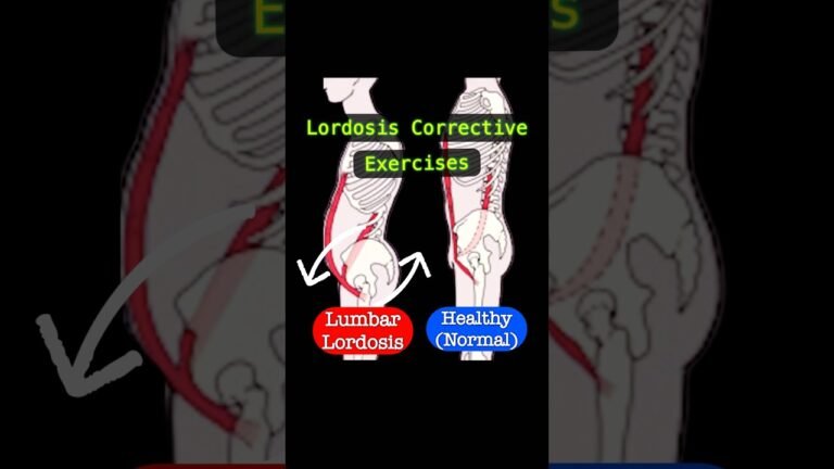 Posture Correction for Back Pain
