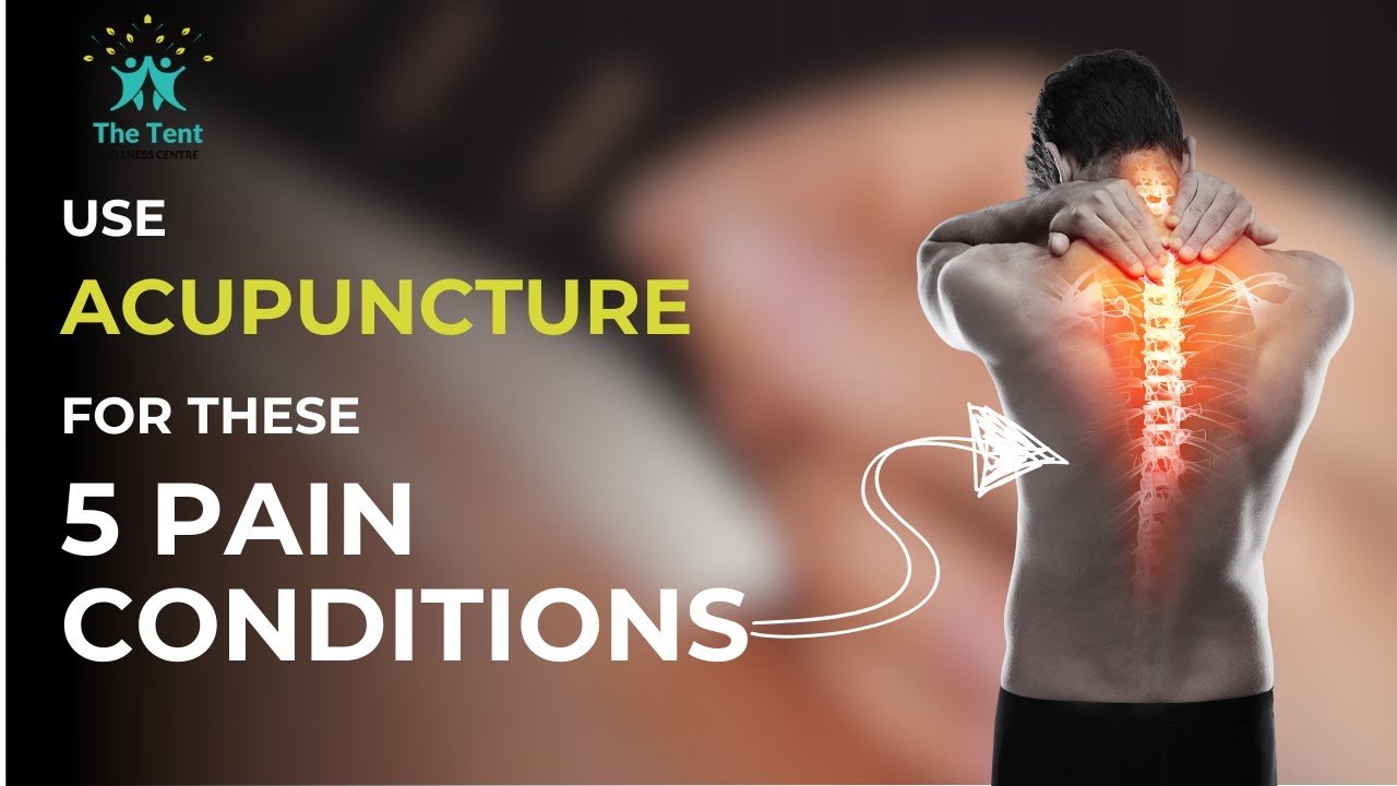 Holistic Approaches to Joint Pain