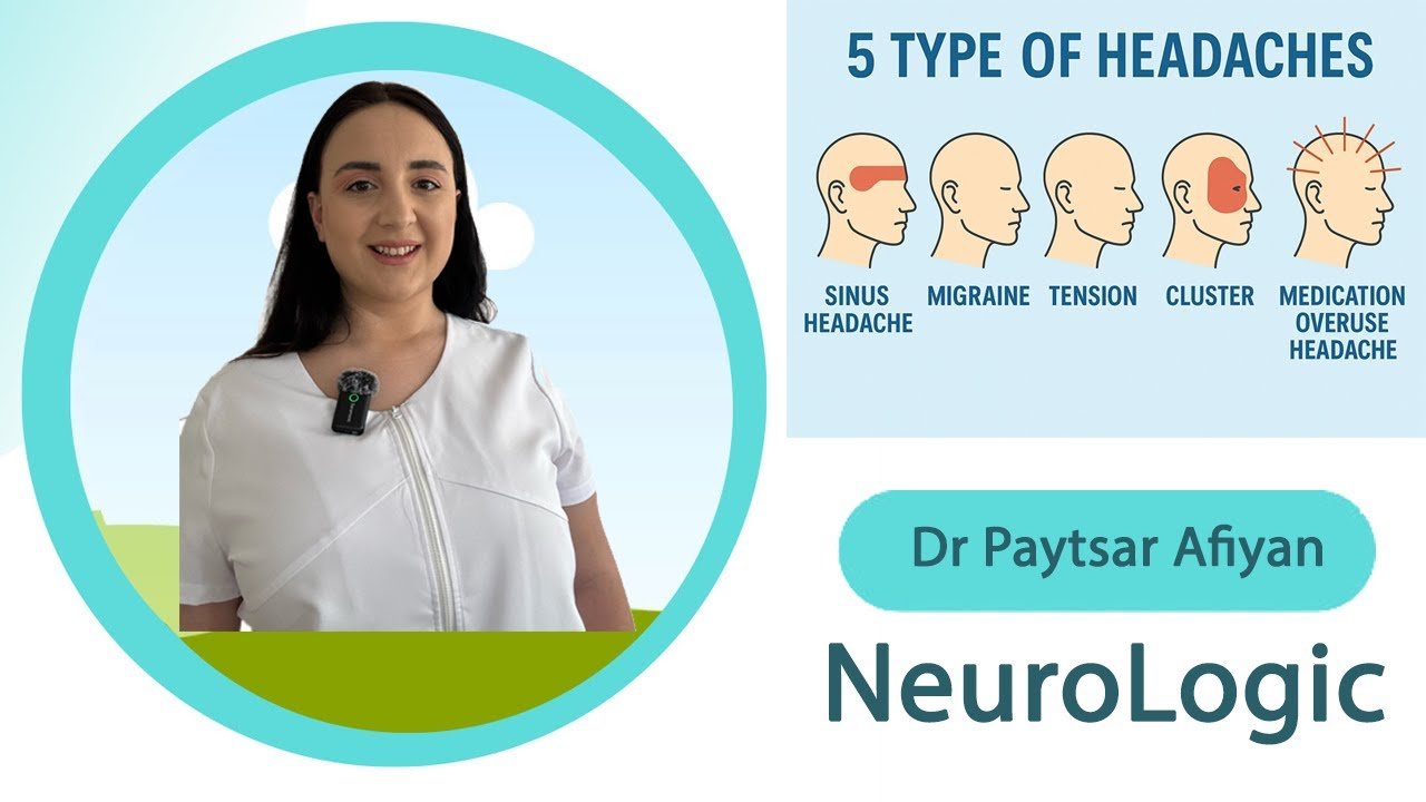 Cluster Headaches Explained