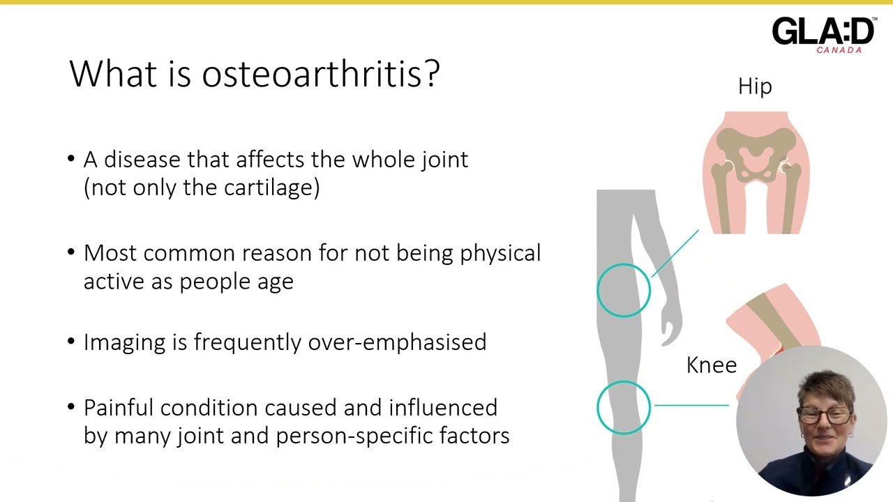 Hip Osteoarthritis Symptoms