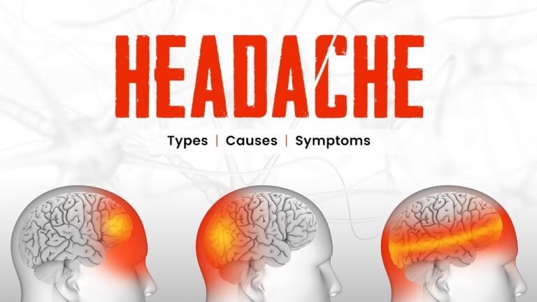 Headache and Physical Activity