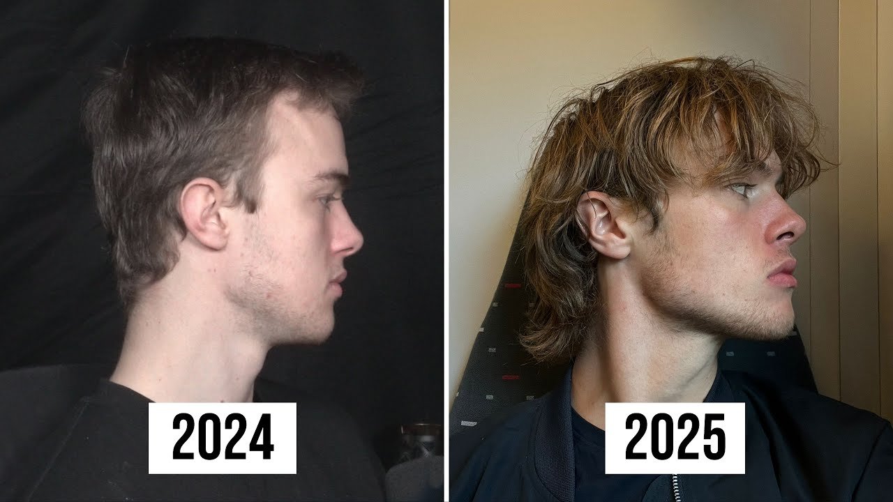 Strengthening Exercises for Neck