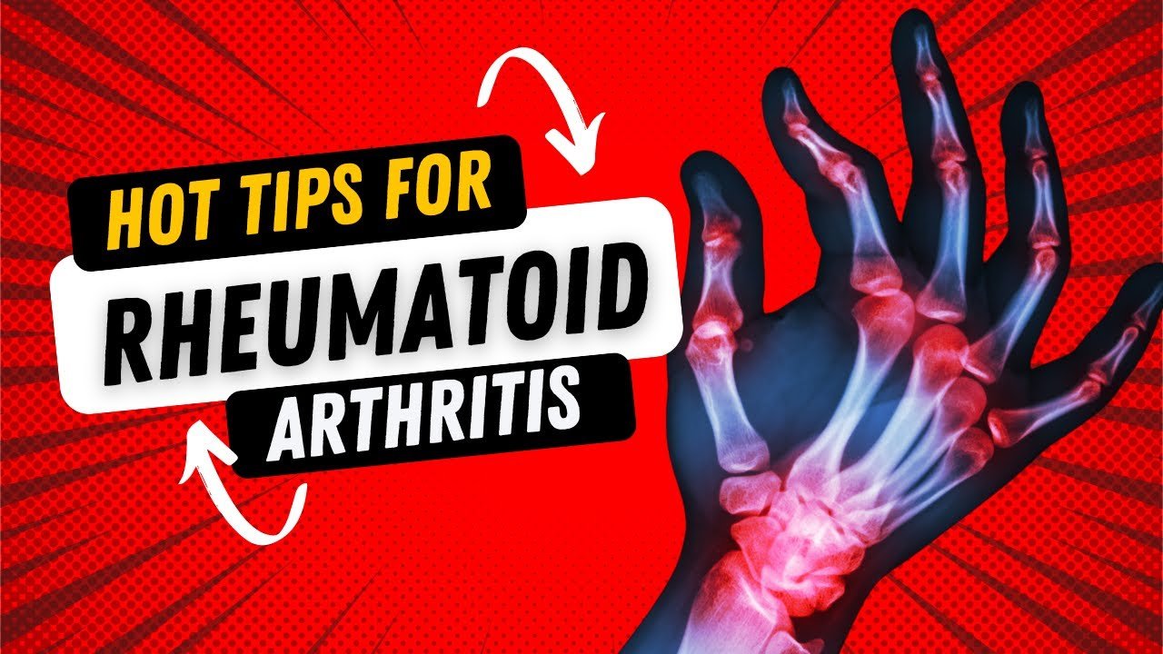 Rheumatoid Arthritis Management