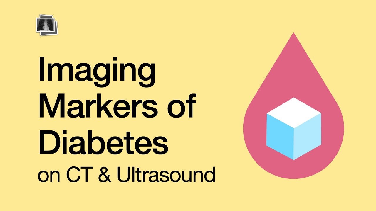 Diabetes