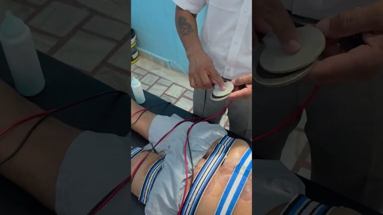 Sciatica Pain Treatment