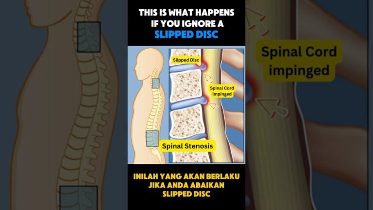 Chronic Neck Pain Causes