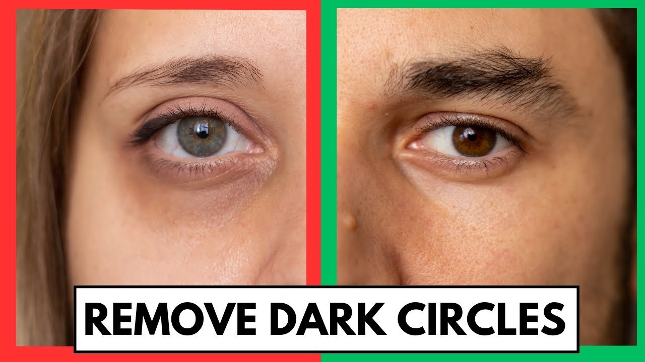 Prostate Massage Techniques
