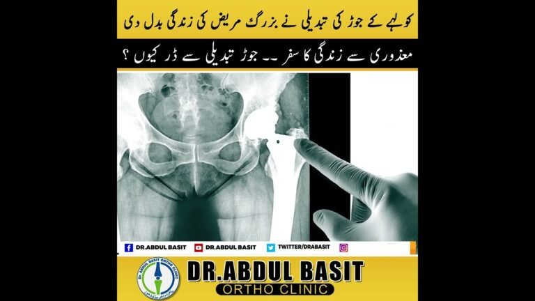 Hip Pain Myths