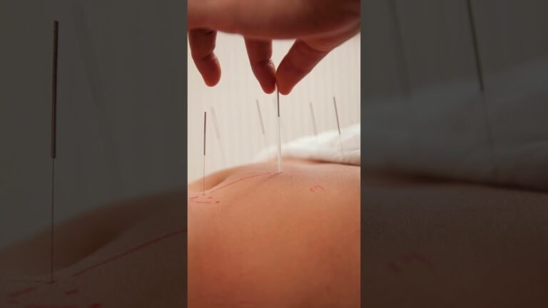 Alternative Treatments for Migraines