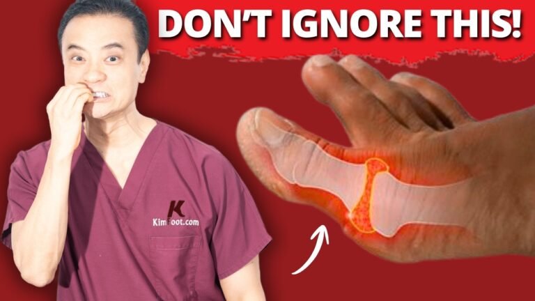 Arthritis Symptoms