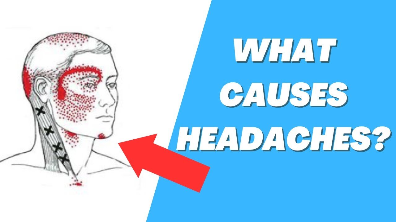 Causes of Headaches